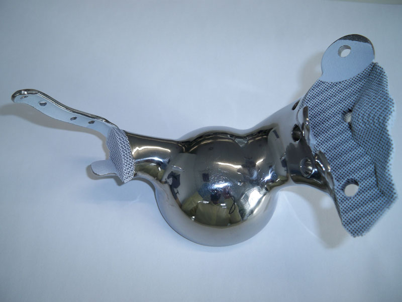 Fig 8. Finished implant medial view